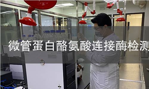 微管蛋白酪氨酸连接酶检测 微管蛋白酪氨酸连接酶检测