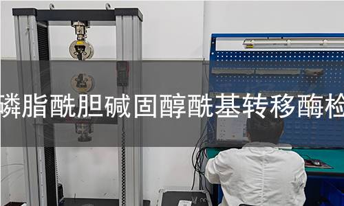  磷脂酰胆碱固醇?；泼讣觳?></div>

                            <h2>检测优势</h2>
                            <div   class=